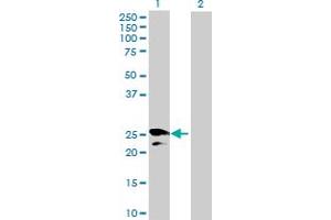 Western Blot analysis of HPGD expression in transfected 293T cell line by HPGD MaxPab polyclonal antibody. (HPGD antibody  (AA 1-266))