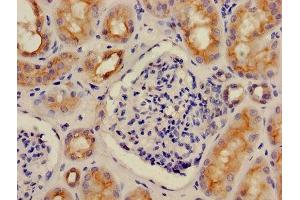 Immunohistochemistry of paraffin-embedded human kidney tissue using ABIN7175262 at dilution of 1:100 (ATP6V1G1 antibody  (AA 2-118))