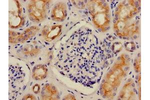 Immunohistochemistry of paraffin-embedded human kidney tissue using ABIN7175262 at dilution of 1:100