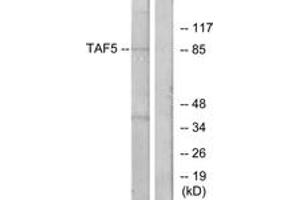 Western blot analysis of extracts from A549 cells, using TAF5 Antibody. (TAF5 antibody  (AA 381-430))