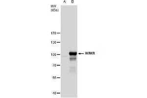 WB Image IKK beta antibody detects IKK beta protein by western blot analysis. (IKBKB antibody  (C-Term))