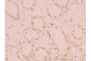 Detection of FGFR1 in Human Kidney Tissue using Polyclonal Antibody to Fibroblast Growth Factor Receptor 1 (FGFR1) (FGFR1 antibody  (AA 236-362))