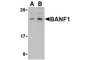 Western blot analysis of BANF1 in human kidney tissue lysate with AP30118PU-N BANF1 antibody at (A) 0.