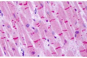 Anti-GRM8 / MGLUR8 antibody IHC staining of human heart. (GRM8 antibody  (N-Term))