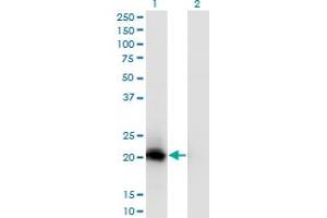 Western Blot analysis of VSTM2L expression in transfected 293T cell line by C20orf102 monoclonal antibody (M02), clone 1A8. (VSTM2L antibody  (AA 25-204))