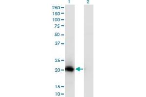 Western Blot analysis of VSTM2L expression in transfected 293T cell line by C20orf102 monoclonal antibody (M02), clone 1A8.