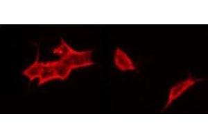 ABIN6268857 staining HT29 by IF/ICC. (CRHR1 antibody  (Internal Region))