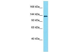 Western Blotting (WB) image for anti-Lemur Tyrosine Kinase 3 (LMTK3) (Middle Region) antibody (ABIN2790811) (LMTK3 antibody  (Middle Region))