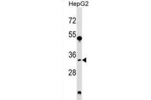 Western Blotting (WB) image for anti-Spermidine Synthase (SRM) antibody (ABIN2999104) (Spermidine Synthase antibody)