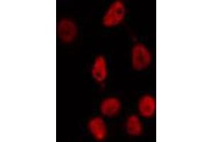 ABIN6274352 staining HepG2 cells by IF/ICC. (E2F2 antibody  (Internal Region))