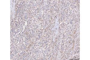 IHC analysis of ANGPT2 using anti-ANGPT2 antibody (ABIN3043725). (Angiopoietin 2 antibody  (AA 19-348))
