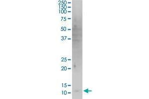 HBXIP monoclonal antibody (M12), clone 4G1.