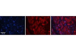 Rabbit Anti-SIX1 Antibody    Formalin Fixed Paraffin Embedded Tissue: Human Adult heart  Observed Staining: Cytoplasmic,Nuclear Primary Antibody Concentration: 1:600 Secondary Antibody: Donkey anti-Rabbit-Cy2/3 Secondary Antibody Concentration: 1:200 Magnification: 20X Exposure Time: 0. (SIX Homeobox 1 antibody  (Middle Region))