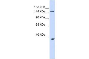 UBE3B antibody used at 1 ug/ml to detect target protein. (UBE3B antibody  (Middle Region))