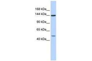 Image no. 1 for anti-Splicing Factor 3b, Subunit 1, 155kDa (SF3B1) (AA 287-336) antibody (ABIN6743003) (SF3B1 antibody  (AA 287-336))