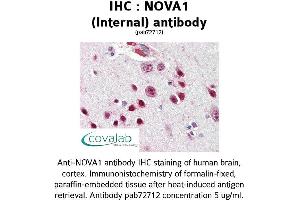 Image no. 1 for anti-Neuro-Oncological Ventral Antigen 1 (NOVA1) (Internal Region) antibody (ABIN1737442) (NOVA1 antibody  (Internal Region))