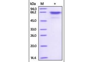 Human Akt1, His Tag & Strep Tag on SDS-PAGE under reducing (R) condition. (AKT1 Protein (AA 1-480) (His tag,Strep Tag))