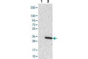 Western blot analysis of Lane 1: Negative control (vector only transfected HEK293T lysate). (LRRC18 antibody)