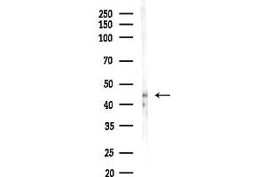 anti-Family with Sequence Similarity 46, Member C (FAM46C) (Internal Region) antibody