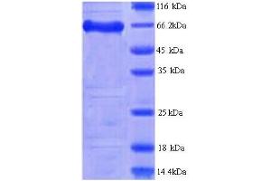 Family with Sequence Similarity 111, Member A (FAM111A) (AA 1-613), (full length) protein (His tag)