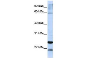 GSTA4 antibody used at 1 ug/ml to detect target protein. (GSTA4 antibody  (C-Term))