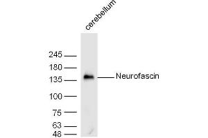 Mouse cerebellum lysates probed with Neurofascin Polyclonal Antibody, unconjugated  at 1:300 overnight at 4°C followed by a conjugated secondary antibody at 1:10000 for 60 minutes at 37°C. (NFASC antibody  (AA 501-650))