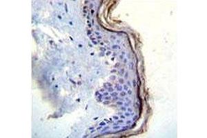 c-Kit antibody immunohistochemistry analysis in formalin fixed and paraffin embedded human skin tissue. (KIT antibody  (AA 106-135))
