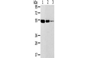 Western Blotting (WB) image for anti-Transmembrane Protease, Serine 11F (TMPRSS11F) antibody (ABIN2427421) (TMPRSS11F antibody)