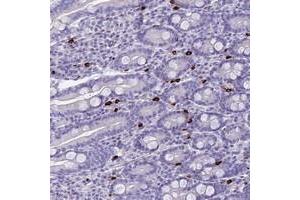Immunohistochemical staining of human duodenum with IL17REL polyclonal antibody  shows selective positivity in a subset of leukocytes at 1:50-1:200 dilution. (IL17REL antibody)