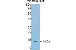 Detection of Recombinant SNCa, Mouse using Polyclonal Antibody to Synuclein Alpha (SNCa) (SNCA antibody  (AA 23-140))