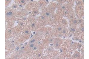Detection of NOTCH4 in Human Liver Tissue using Polyclonal Antibody to Notch Homolog 4 (NOTCH4) (NOTCH4 antibody  (AA 1715-2001))