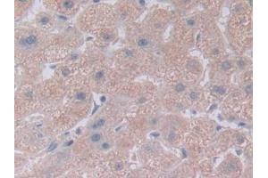 Detection of NOTCH4 in Human Liver Tissue using Polyclonal Antibody to Notch Homolog 4 (NOTCH4) (NOTCH4 antibody  (AA 1715-2001))