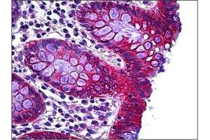 Human Colon: Formalin-Fixed, Paraffin-Embedded (FFPE) (RHOH antibody  (C-Term))