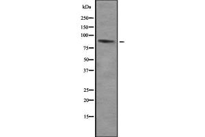 Western blot analysis of ZNF785 using HepG2 whole cell lysates (ZNF785 antibody)