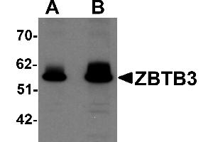 Western Blotting (WB) image for anti-Zinc Finger and BTB Domain Containing 3 (ZBTB3) (C-Term) antibody (ABIN1030811) (ZBTB3 antibody  (C-Term))