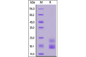 Mouse IL-17A, His Tag on  under reducing (R) condition. (Interleukin 17a Protein (AA 26-158) (His tag))