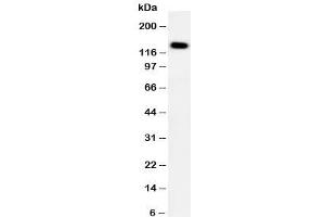 Western blot testing of PTCH2 antibody and HeLa cell lysate. (Patched 2 antibody  (C-Term))
