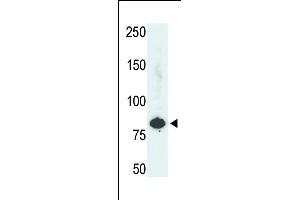 The anti-PFKL Pab (ABIN392745 and ABIN2842201) is used in Western blot to detect PFKL in HepG2 cell lysate. (PFKL antibody  (C-Term))