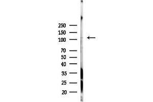 anti-Endoplasmic Reticulum Aminopeptidase 1 (ERAP1) (Internal Region) antibody