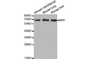Western blot analysis of extracts of various cell lines, using AFP antibody. (alpha Fetoprotein antibody  (AA 360-609))