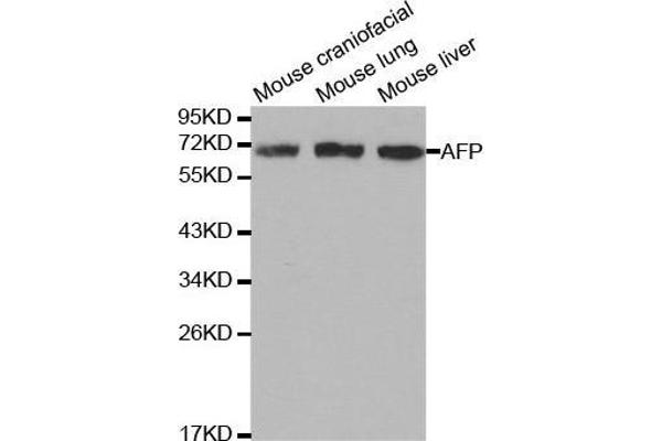 alpha Fetoprotein antibody  (AA 360-609)