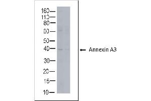 Rabbit anti Annexin A3 on human tonsil lysate (Annexin A3 antibody)