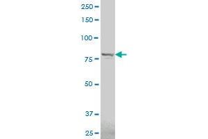 TROAP polyclonal antibody (A01), Lot # 051214JC01 Western Blot analysis of TROAP expression in IMR-32 . (TROAP antibody  (AA 181-280))