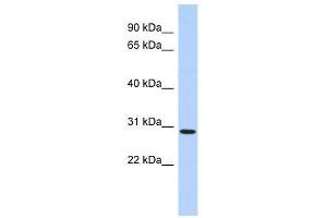 SERTAD2 antibody used at 0. (SERTAD2 antibody  (N-Term))