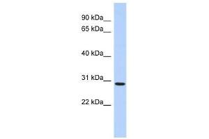 SERTAD2 antibody used at 0. (SERTAD2 antibody  (N-Term))