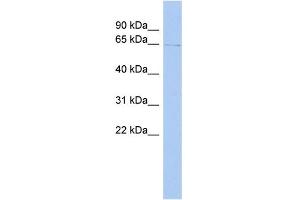WB Suggested Anti-TIGD1 Antibody Titration: 0. (TIGD1 antibody  (Middle Region))