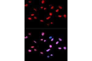 Immunofluorescence analysis of U2OS cells using Phospho-Rb-S811 antibody (ABIN5969933). (Retinoblastoma 1 antibody  (pSer811))