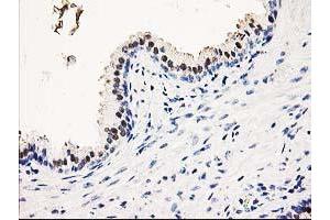 Immunohistochemical staining of paraffin-embedded Human prostate tissue using anti-SMS mouse monoclonal antibody. (SMS antibody)