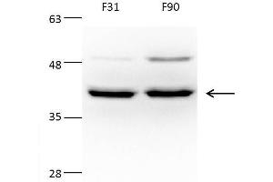 Western Blotting (WB) image for anti-Acetyl-CoA Acetyltransferase 1 (ACAT1) (N-Term) antibody (ABIN2855445)
