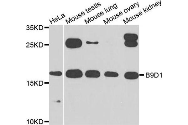 B9D1 antibody